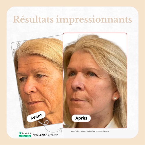 Celyana Baume au Calcium Repulpant